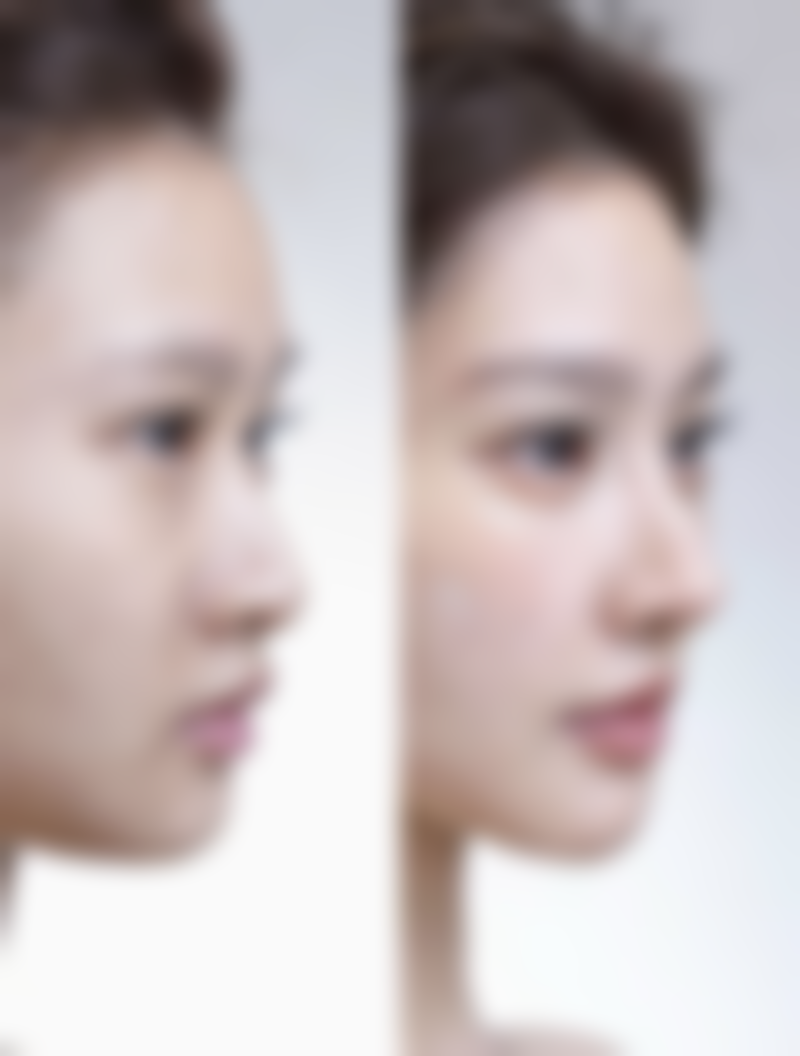 福建宁德东侨东韩整形医疗美容医院怎么预约