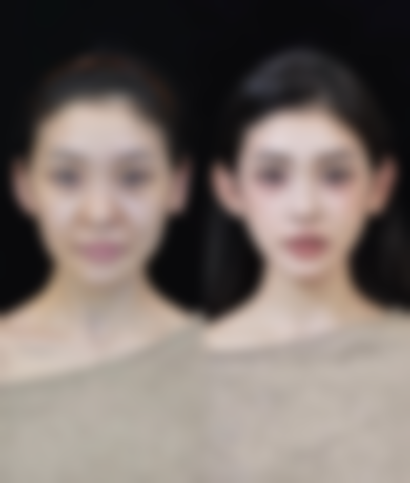 填充治疗的成效能维持多久呢？