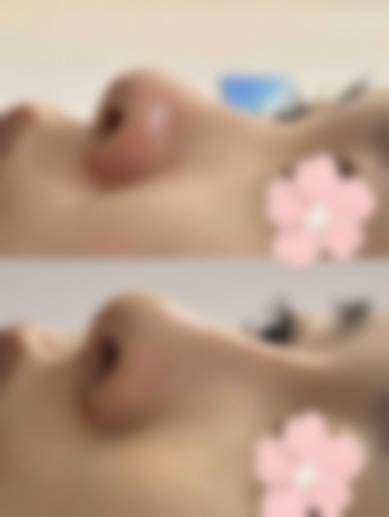 福建宁德东侨东韩整形医疗美容医院正规吗？