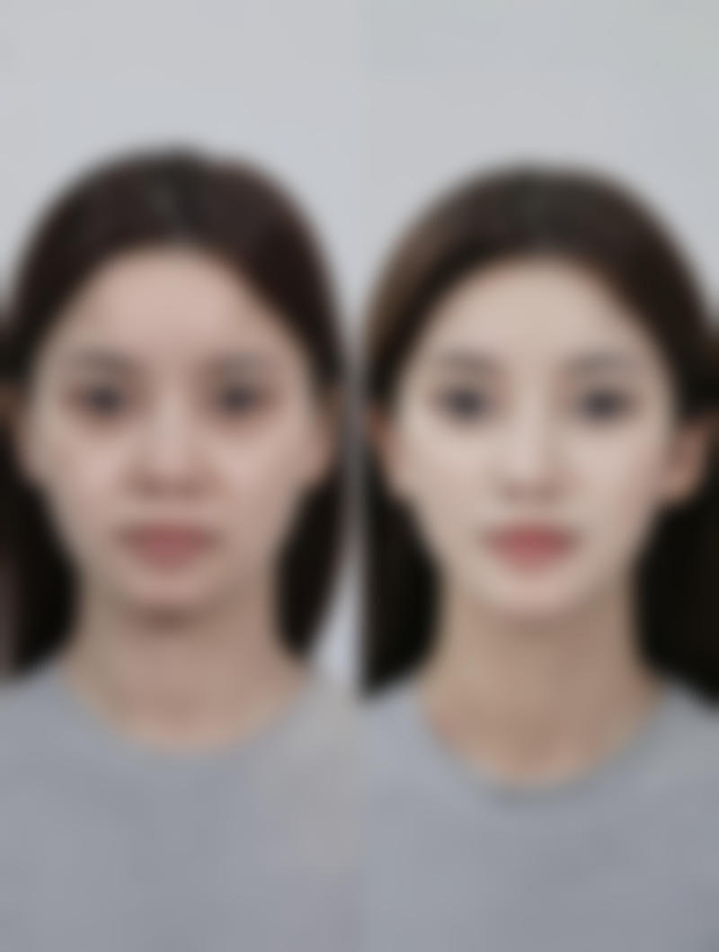 上海星和医疗美容医院杞孟衿医生擅长项目