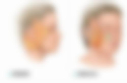 综合隆鼻修复过程中有哪些正常现象和异常信号?