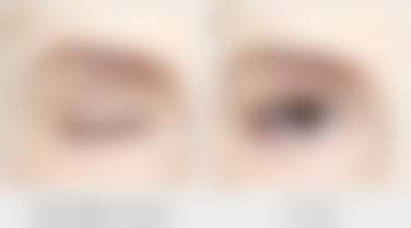 长沙芊亿医疗美容门诊口碑评价怎么样？