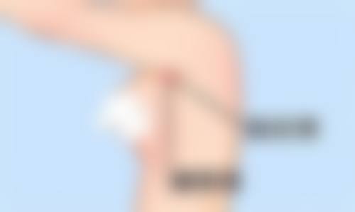 双鸭山市孙笠整形医院口碑评价怎么样?