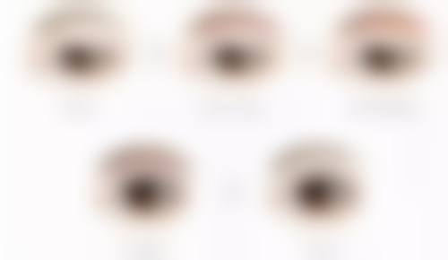 综合隆鼻后多久能恢复？通常1 - 3个月基本消肿，3 - 6个月完全恢复！ 