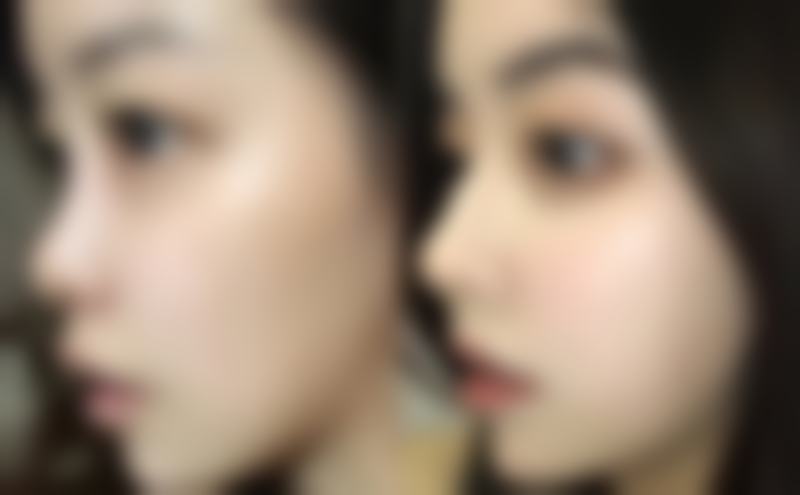 上海铂诗玥御翠整形医院正规吗?