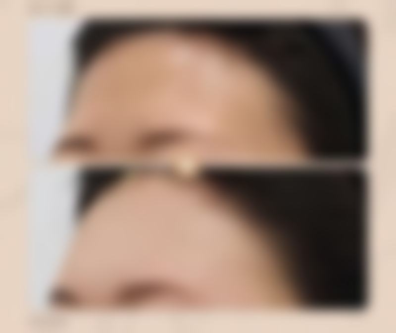 邢台市巨鹿县医院医学美容科口碑评价怎么样?