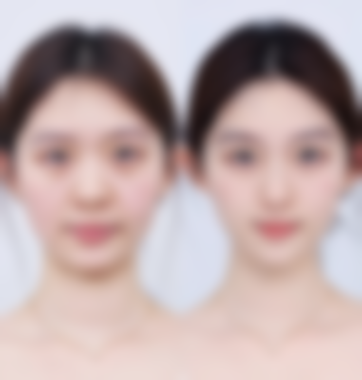 安徽合肥颜赞整形医院怎么预约