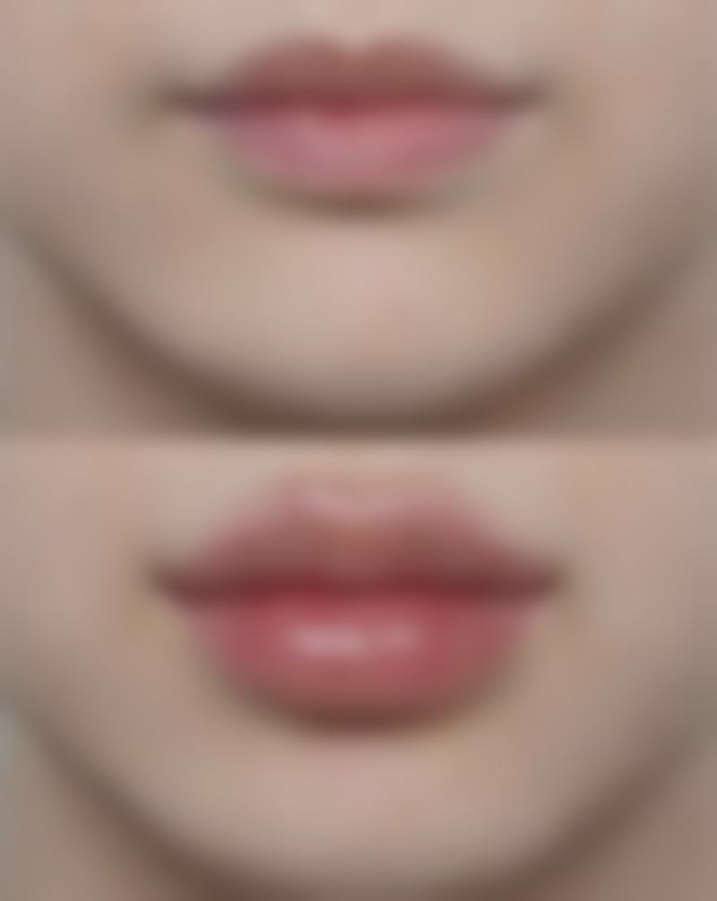 邢台市巨鹿县医院医学美容科怎么预约