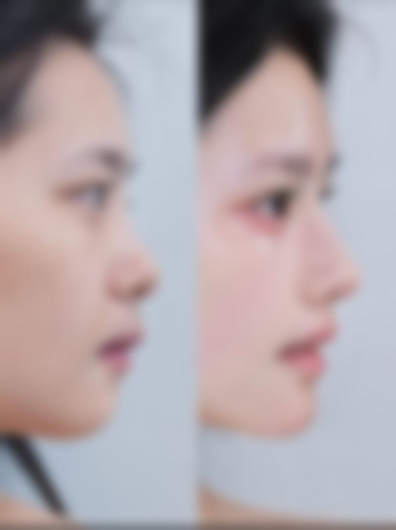 郴州市美科医疗美容医院正规吗？