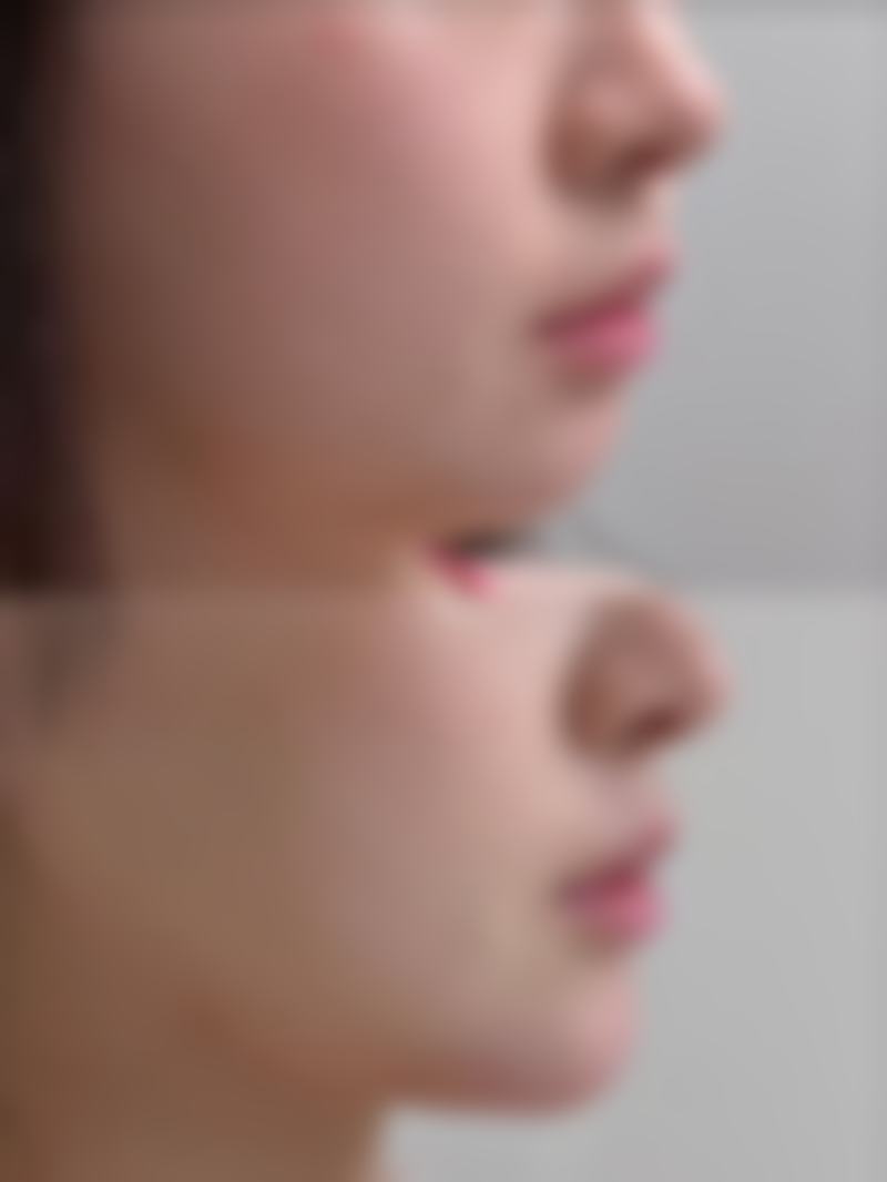 武汉长江航运总医院怎么预约