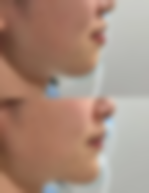 日照明浩牙科诊所口碑评价怎么样？