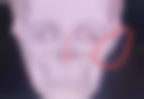 西安悦时光医疗美容诊所正规吗？