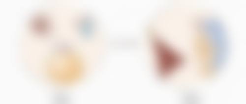 运城丽霞医疗美容诊所姚丽霞医生割双眼皮技术怎么样?