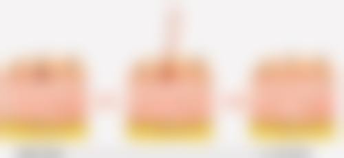 天津佳艺医疗美容诊所张守玲医生鼻部整形技术怎么样？