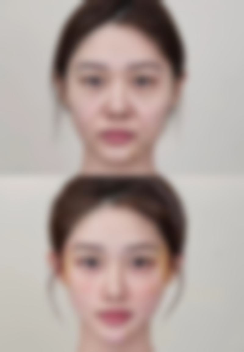 运城丽霞医疗美容诊所姚丽霞医生患者评价