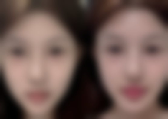 青岛福田医疗美容医院口碑评价怎么样？