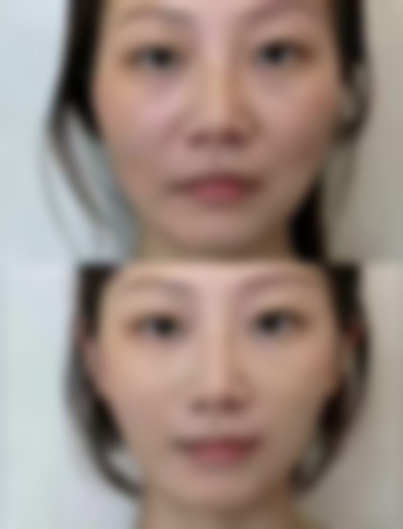 哈尔滨美之术整形医疗美容医院怎么预约