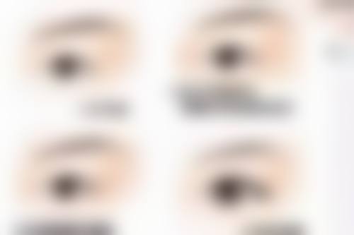 5G光雕吸脂的收费标准是怎样的呢？