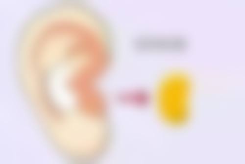 手术疤痕完全修复到与周围皮肤一致需要多久?