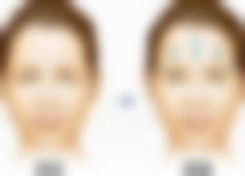 大连天俪医疗美容口碑评价怎么样？