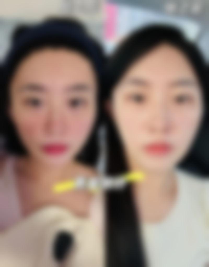 梅州市人民医院烧伤整形修复外科口碑评价怎么样？