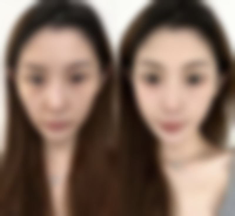 昆明丽都仁爱医疗美容医院怎么预约