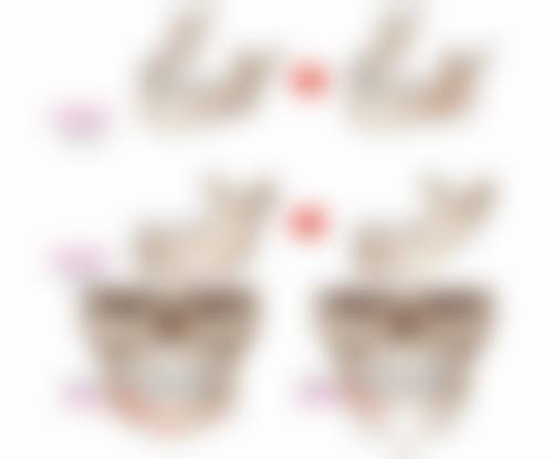 湖南省第二人民医院医学整形美容科徐毅医生患者评价