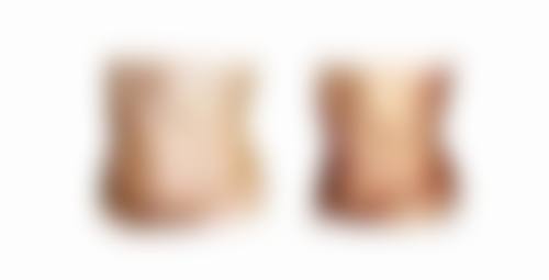 割完双眼皮太窄了怎么办？可以通过修复手术调整，还需注意哪些护理要点？ 