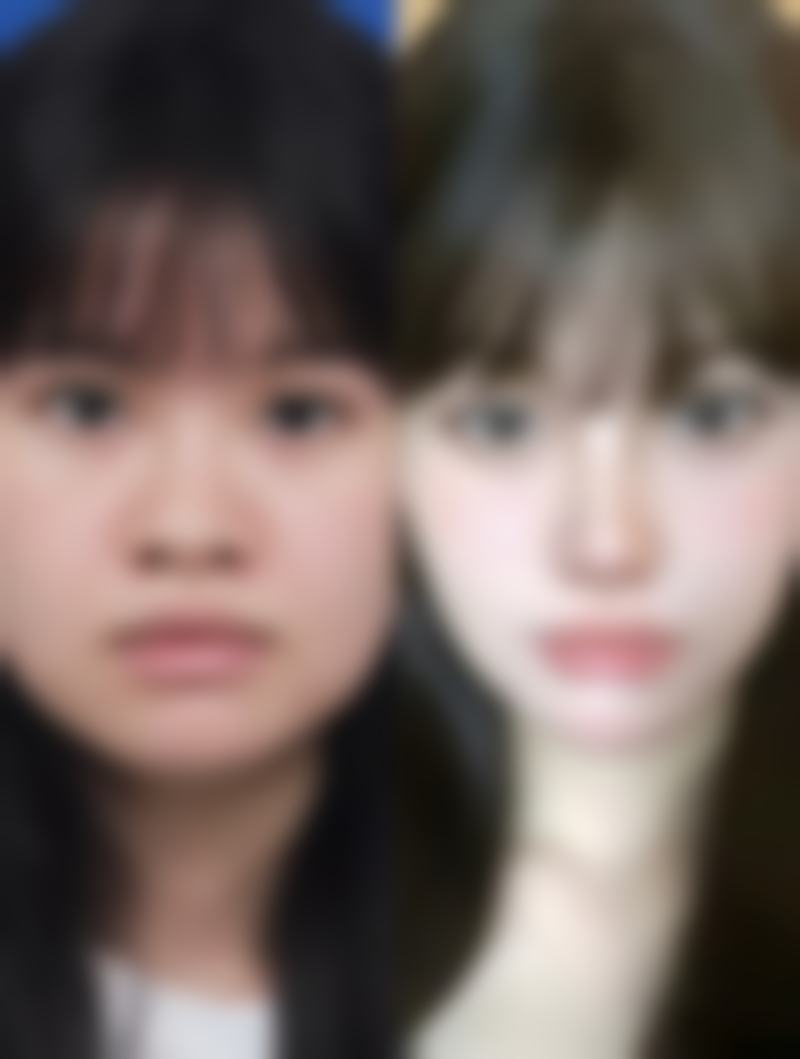 杭州韩佳医疗整形门诊部朴相恩医生韩式鼻部整形技术怎么样？