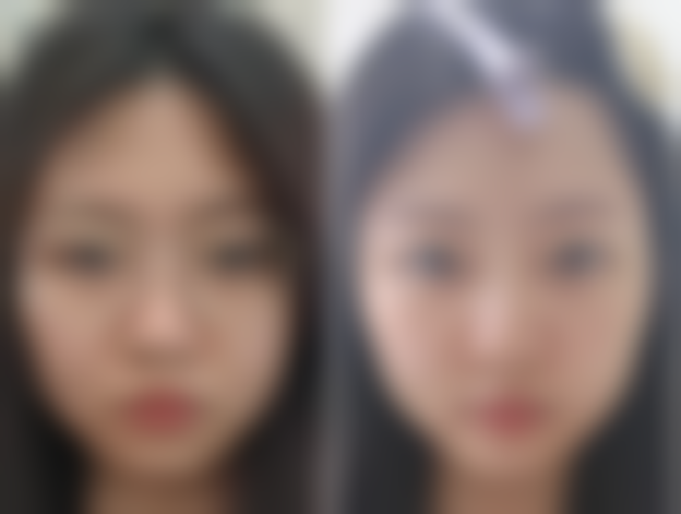 什么是联合治疗方案呢?