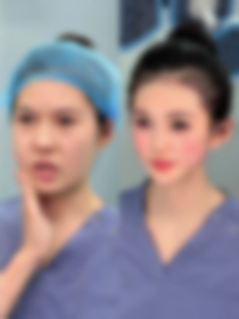 有哪些非手术祛眼袋的方法呢?