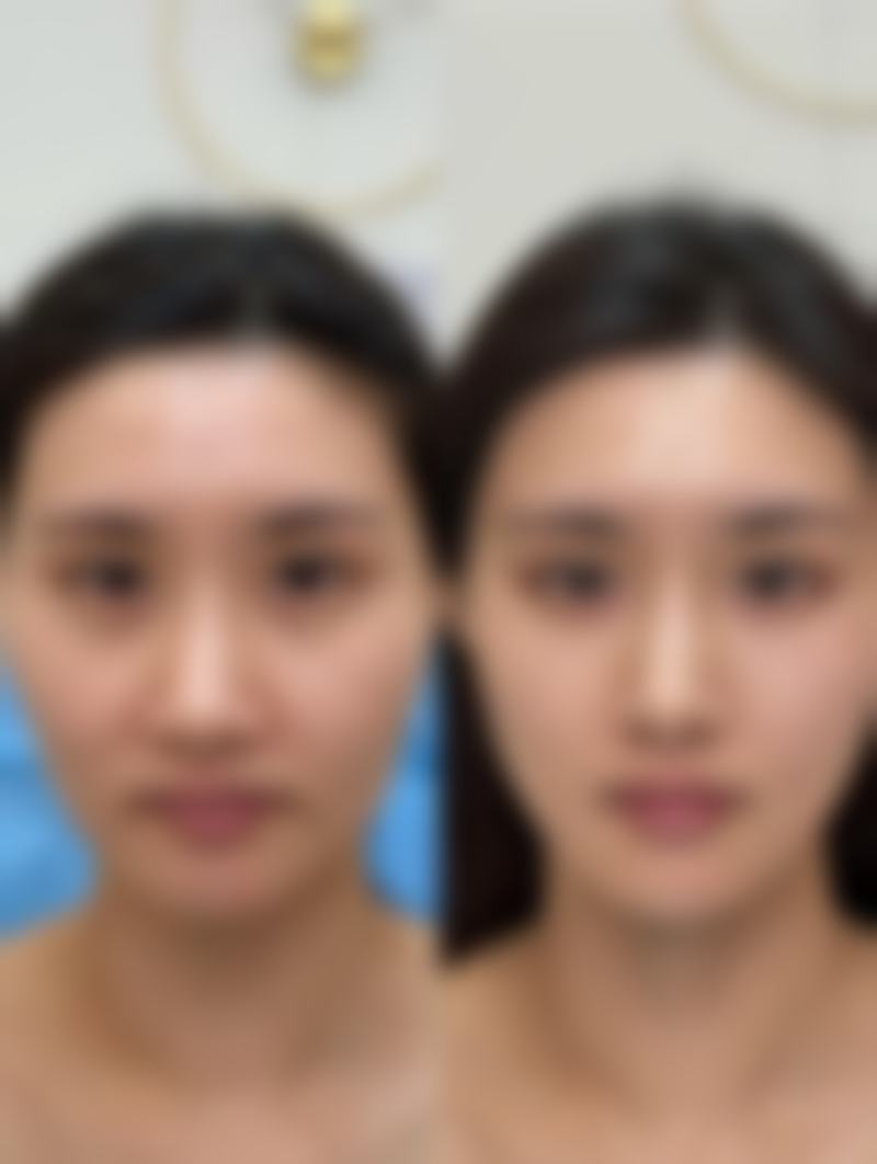 温州芯美昕医疗美容门诊部正规吗？