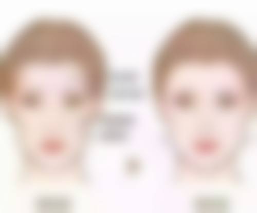 术后护理对疤痕增生治疗有什么重要性，要怎么做？