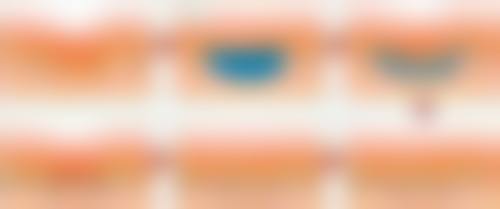 宁波雅致医疗美容诊所口碑评价怎么样？