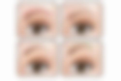 痘痘引起的增生性疤痕有什么好的治疗方案？