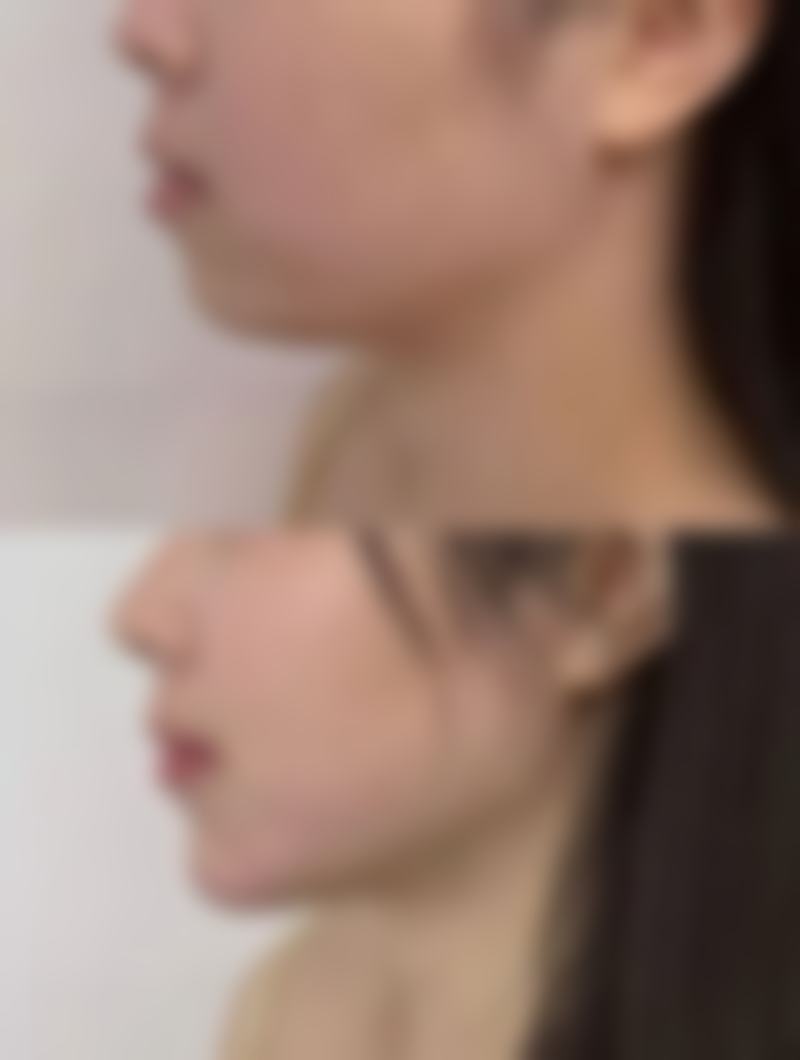 （整形科）威海东大医院正规吗？