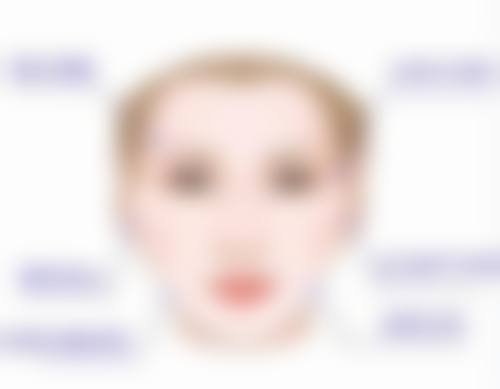 术后需要避免剧烈运动的时段是多久？