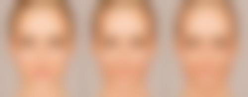 不同假体类型的软化时间有差异吗？