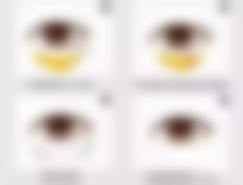 威海可人整形美容机构郭杰医生医生隆鼻技术怎么样？