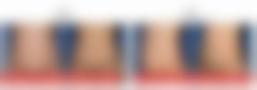 威海威高梨花美容整形医院正规吗？