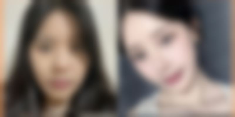 非手术方法各有什么优缺点和注意事项？