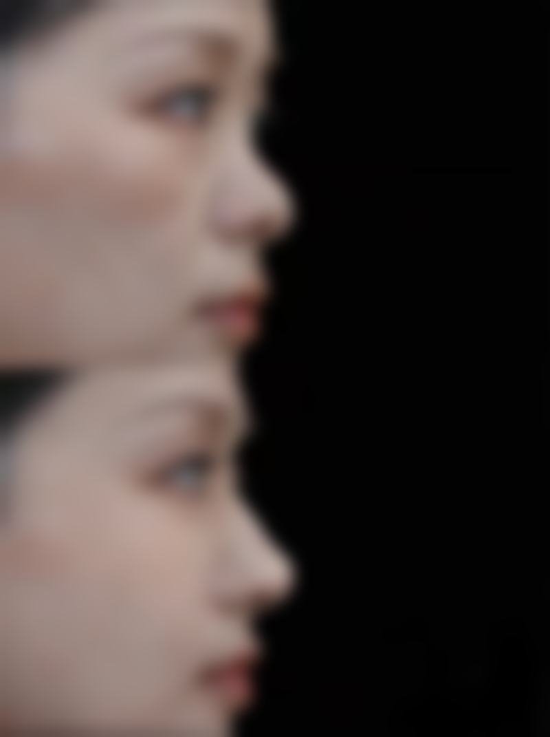 铁岭张涛整形医院口碑评价怎么样？