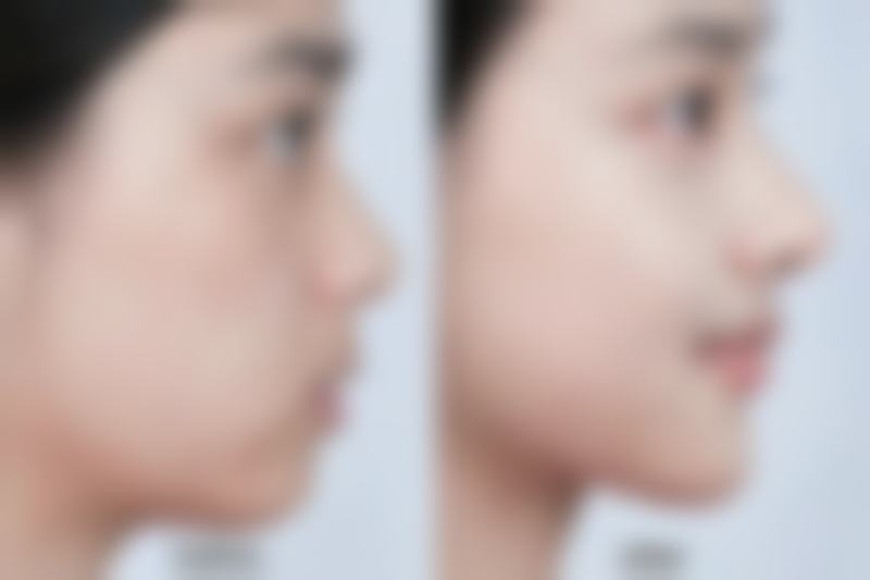 苏州恩美医疗美容诊所口碑评价怎么样？