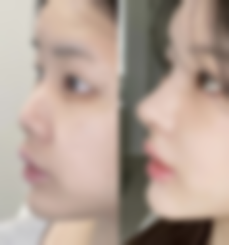 苏州恩美医疗美容诊所正规吗？