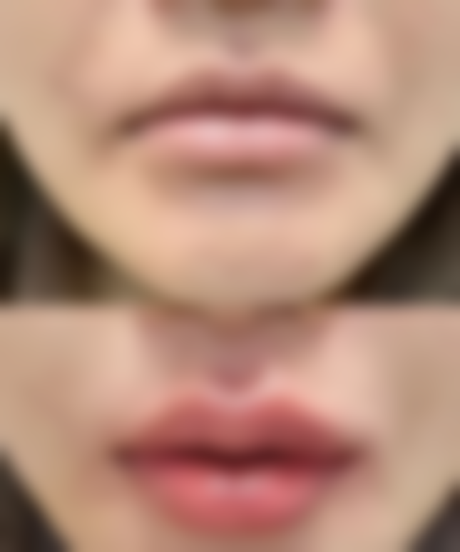 龙岩华美医疗美容医院林才娘医生擅长项目