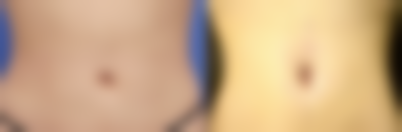 韩国可恩爱整形外科医院口碑评价怎么样？