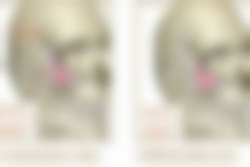 植发后毛囊存活率低怎么办？