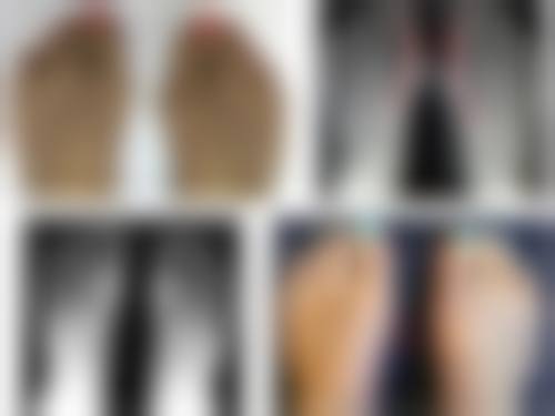 按摩减轻眼袋需要注意什么？