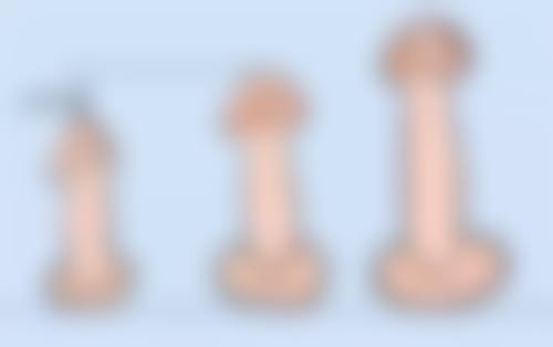 植发后后枕部取发区会有明显痕迹吗？