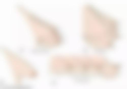 药物治疗适合什么样的1厘米疤痕？